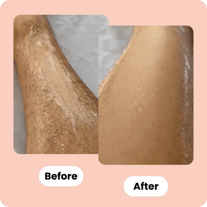 Nazo™ - Veiligheids Scheermes | 1+1 GRATIS|