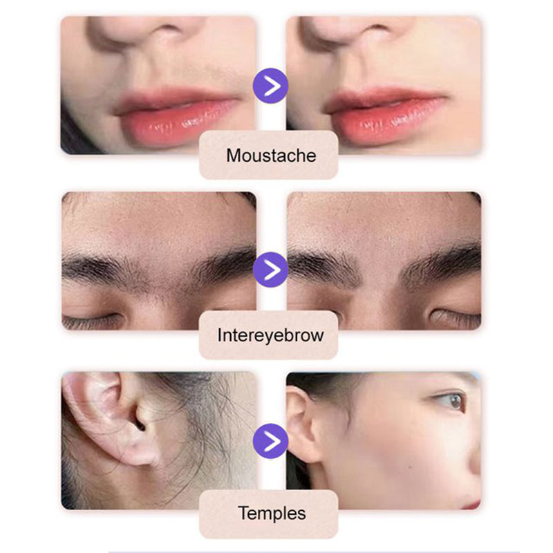 DouceGlow™ – Ontharingscrème voor het Gezicht Voor Gevoelige Huid | 1+1 GRATIS